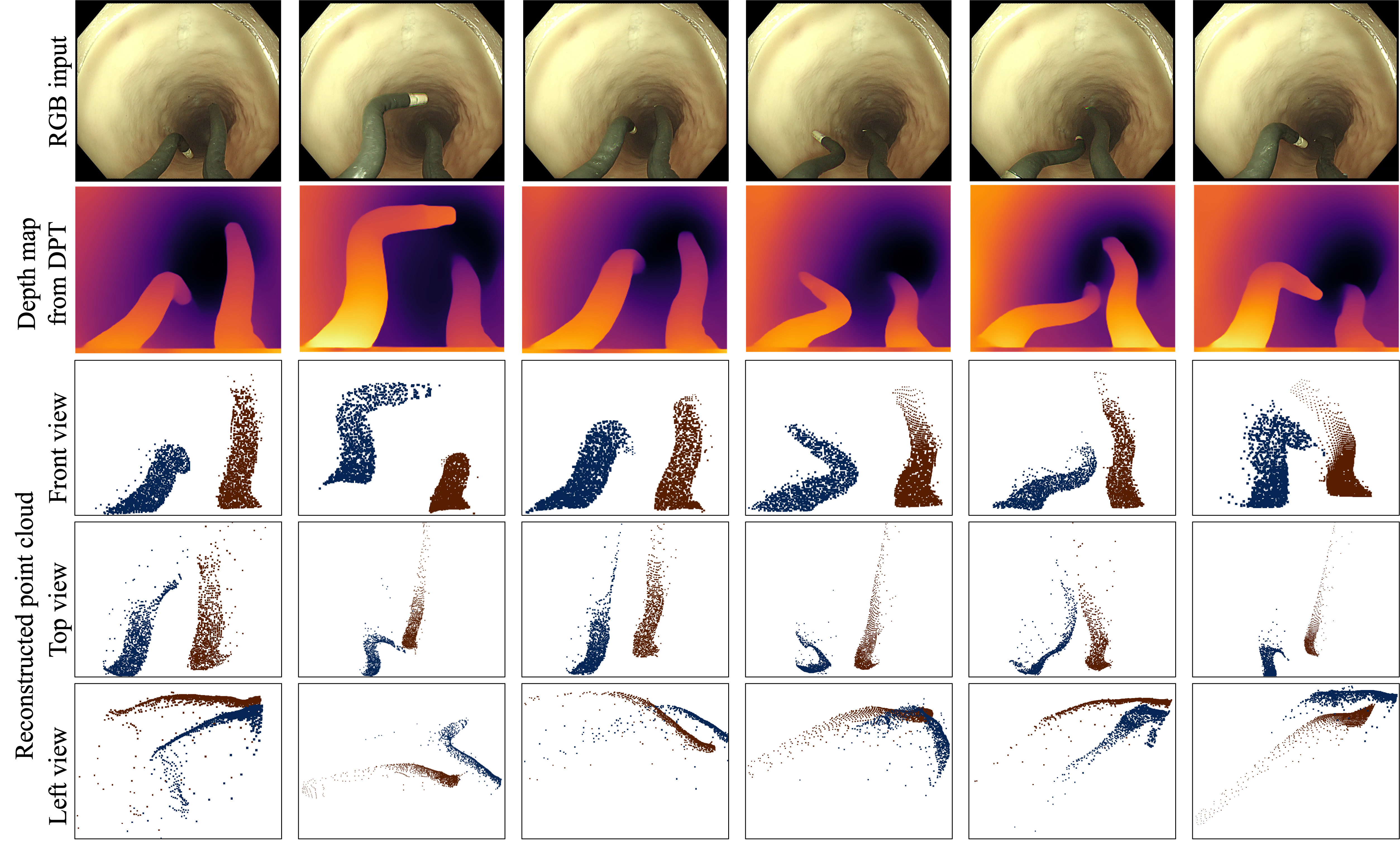 Interpolation end reference image.